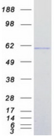 SDS PAGE (IRF7-897H).jpg